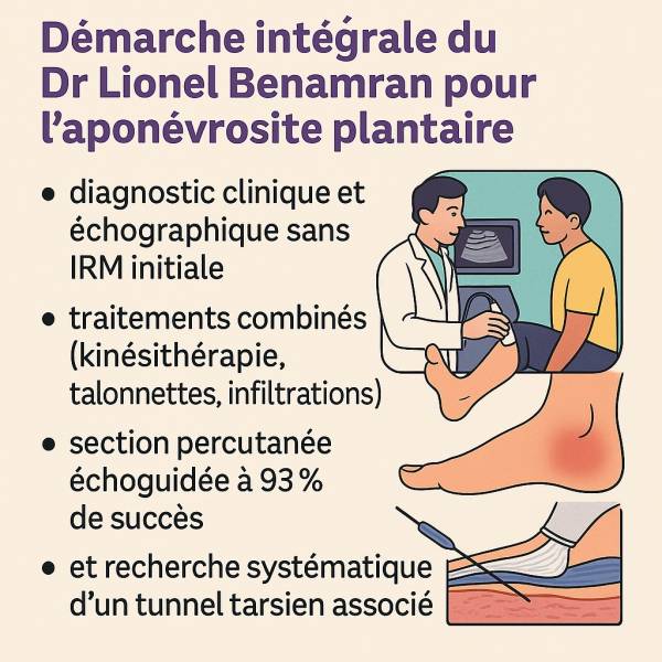 approche de l'aponévrose plantaire