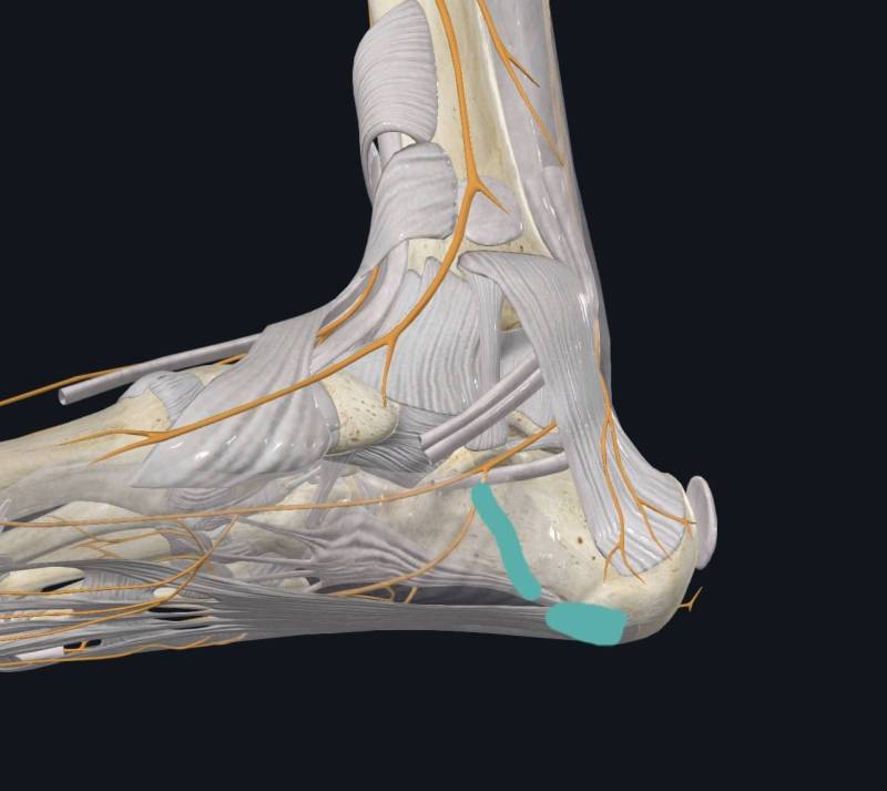 nerf de baxter et enthese de l'aponévrose plantaire pathologique