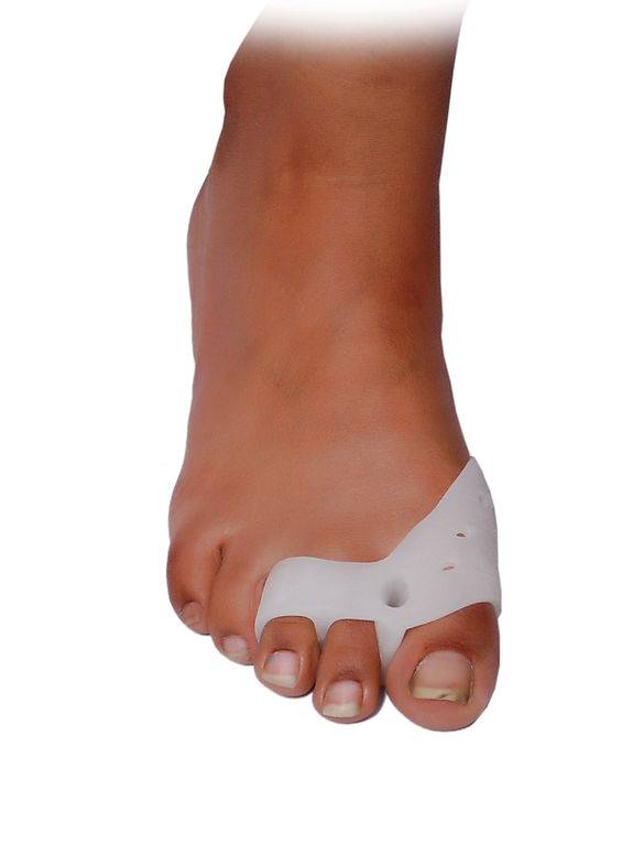 Traiter un Hallux Valgus avec un chirurgien spécialisé dans le pied à Paris