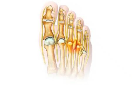 Notre zone d'activité pour ce service Chirurgien spécialisé dans le pied à Paris 75 en Île-de-France